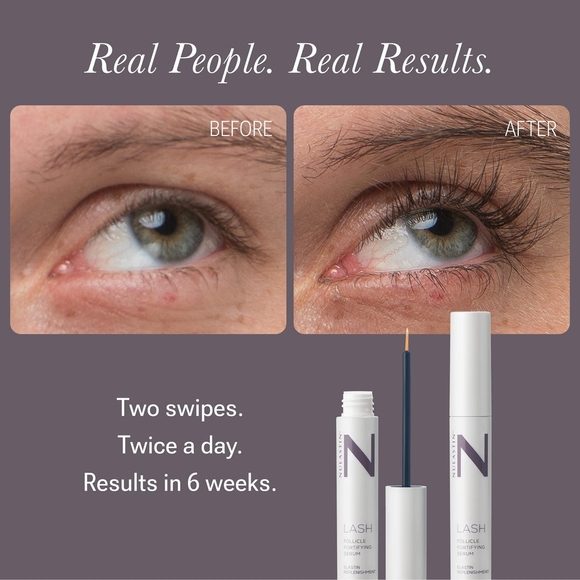NIB Nulastin Lash Follicle Fortifying Serum Full Size 3mL Retail Price $84.00 - Picture 3 of 6